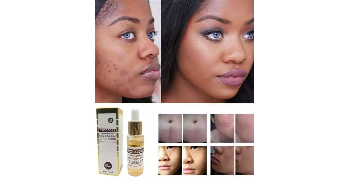 Concentré Gluta White - Soin Blanchissant Anti-Taches - Enlève Contour Noir - 100 Ml FPS5